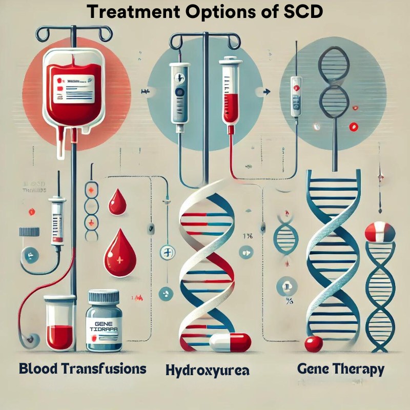 Sickle Cell Disease UPSC